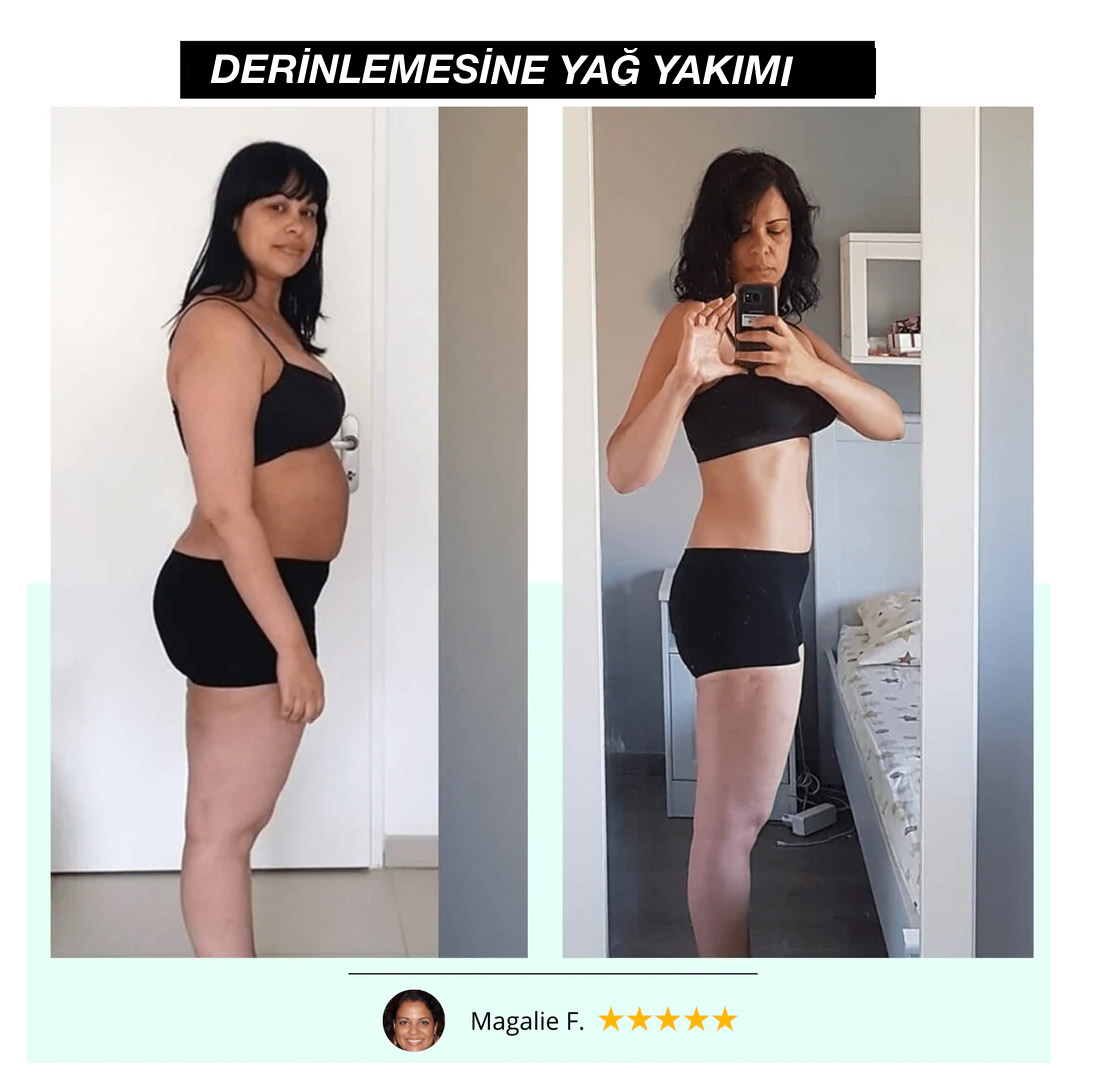 VibraKeyf: Profesyonel Vücut Şekillendirici & Selülit Giderici - 2