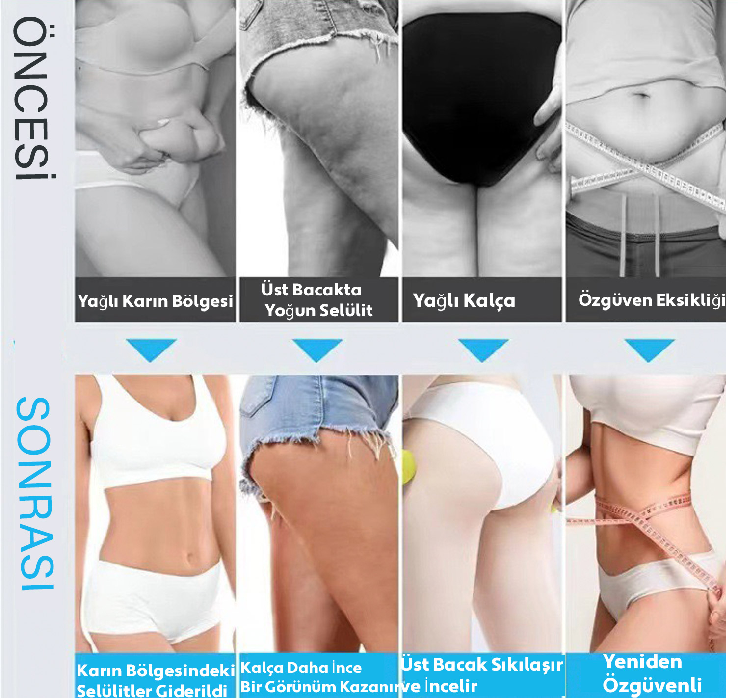 VibraKeyf: Profesyonel Vücut Şekillendirici & Selülit Giderici - 5